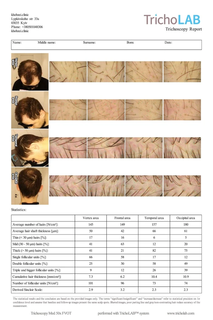 Результат вимірювання морфометричних параметрів волосся